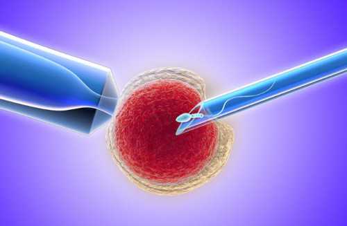 宫颈环扎术保胎成功率解析与关键因素